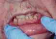 Fig 1.