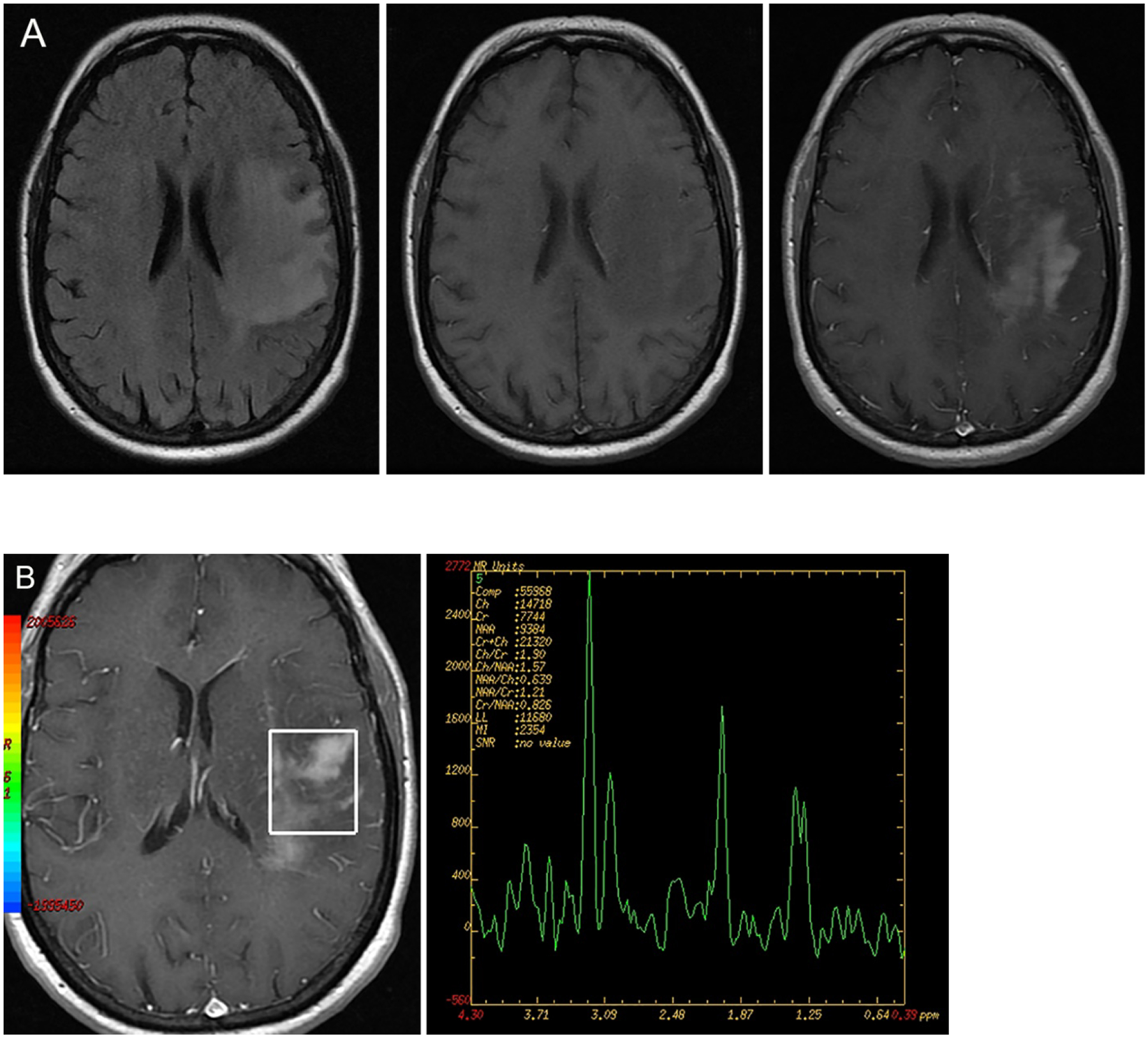 Figure 5A and 5B: