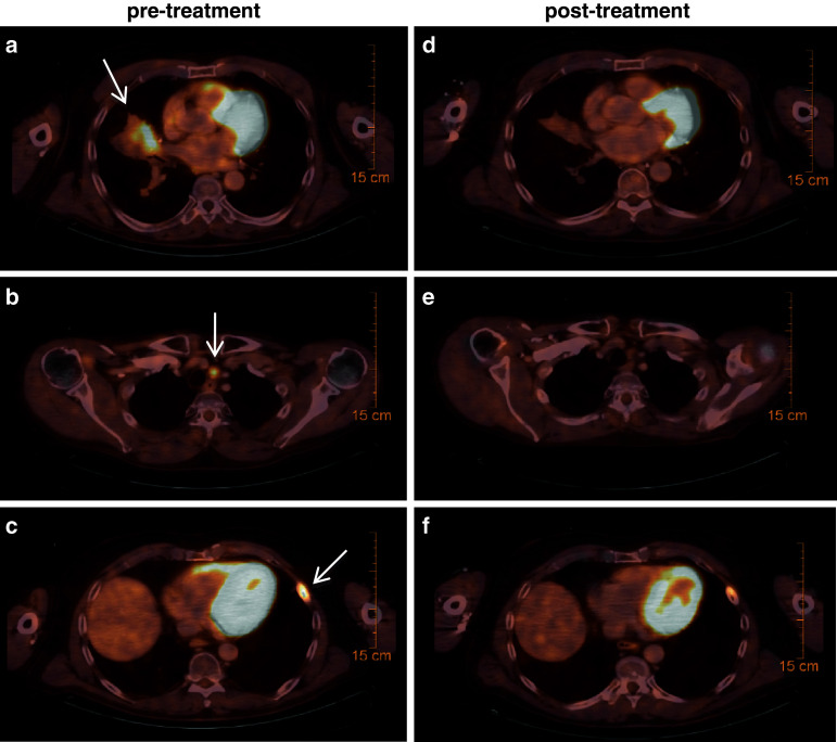 Fig. 2