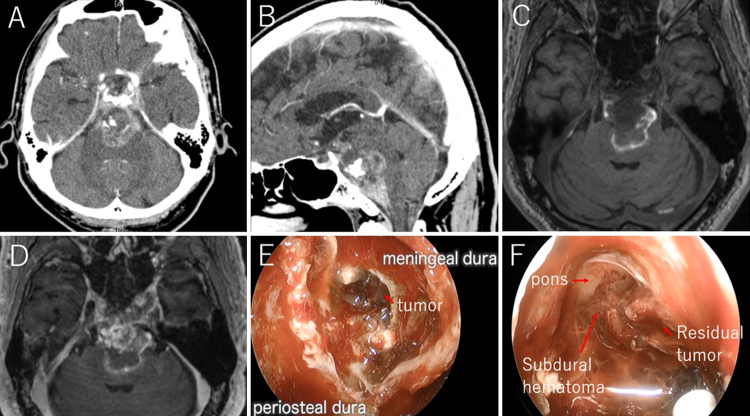 FIG. 1.