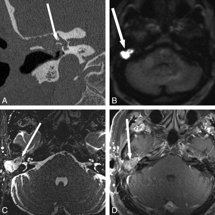 Fig 4.