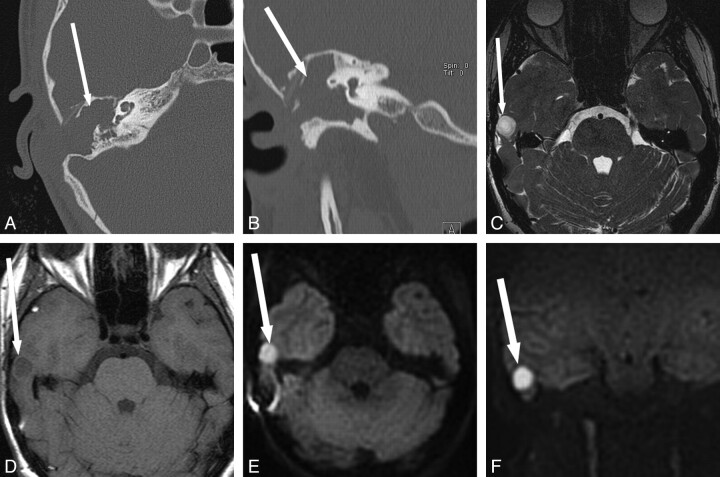 Fig 3.