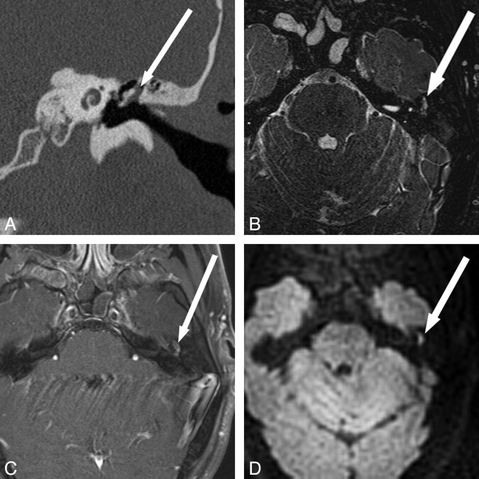 Fig 5.