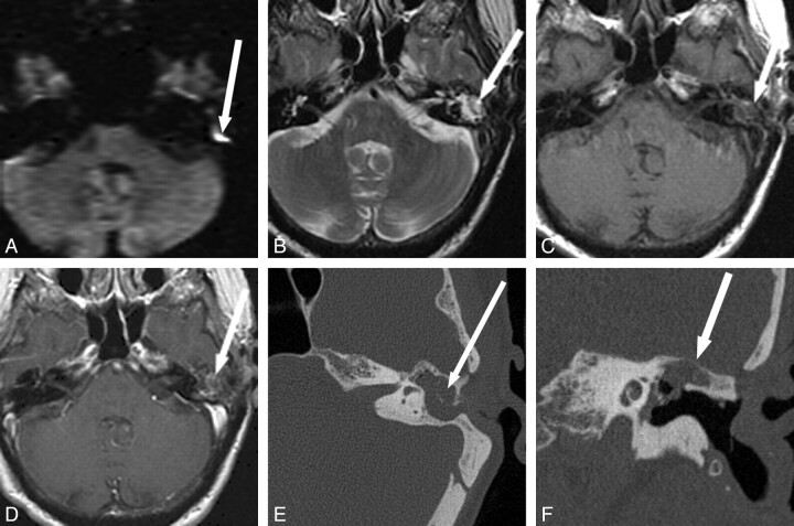 Fig 6.