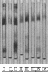 255