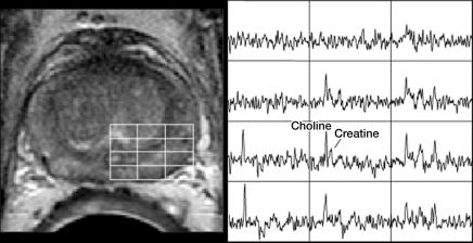 Figure 1b: