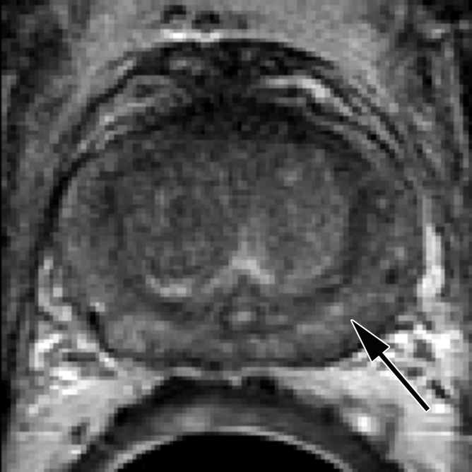 Figure 1a: