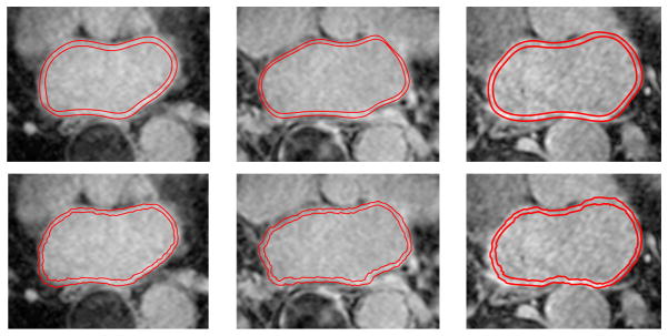 Figure 11