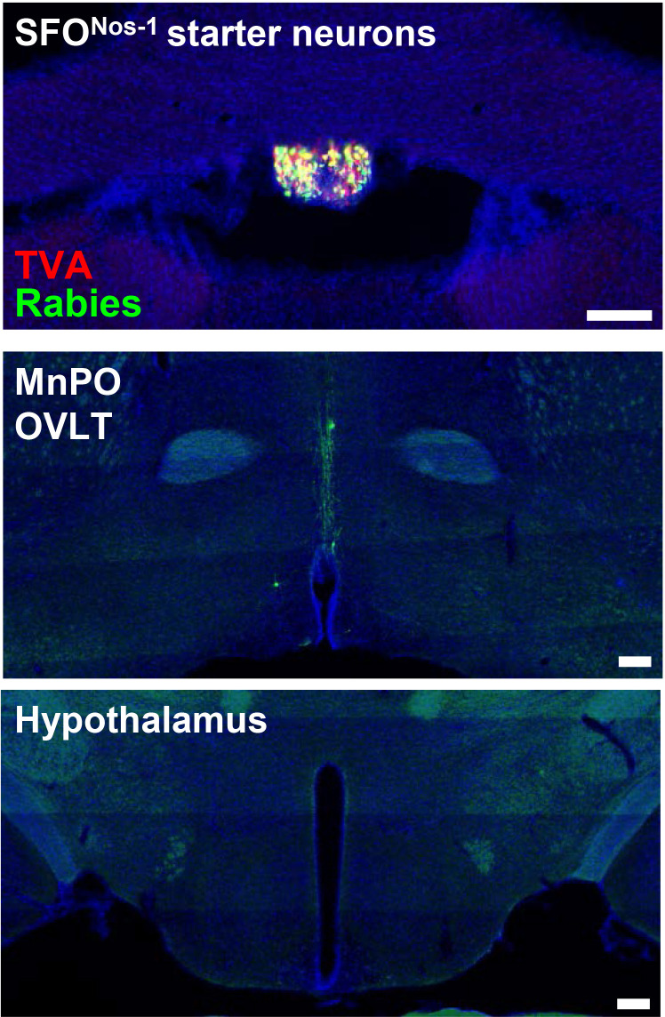 Figure 3—figure supplement 1.