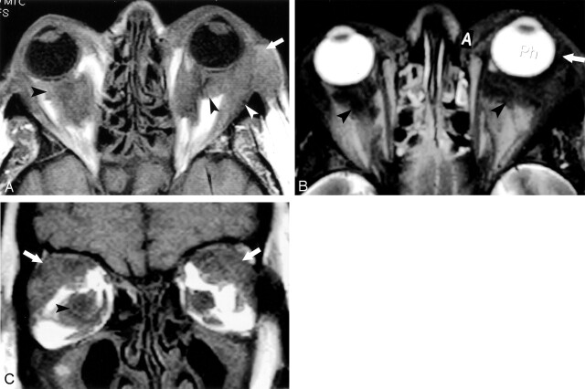 Fig 1.