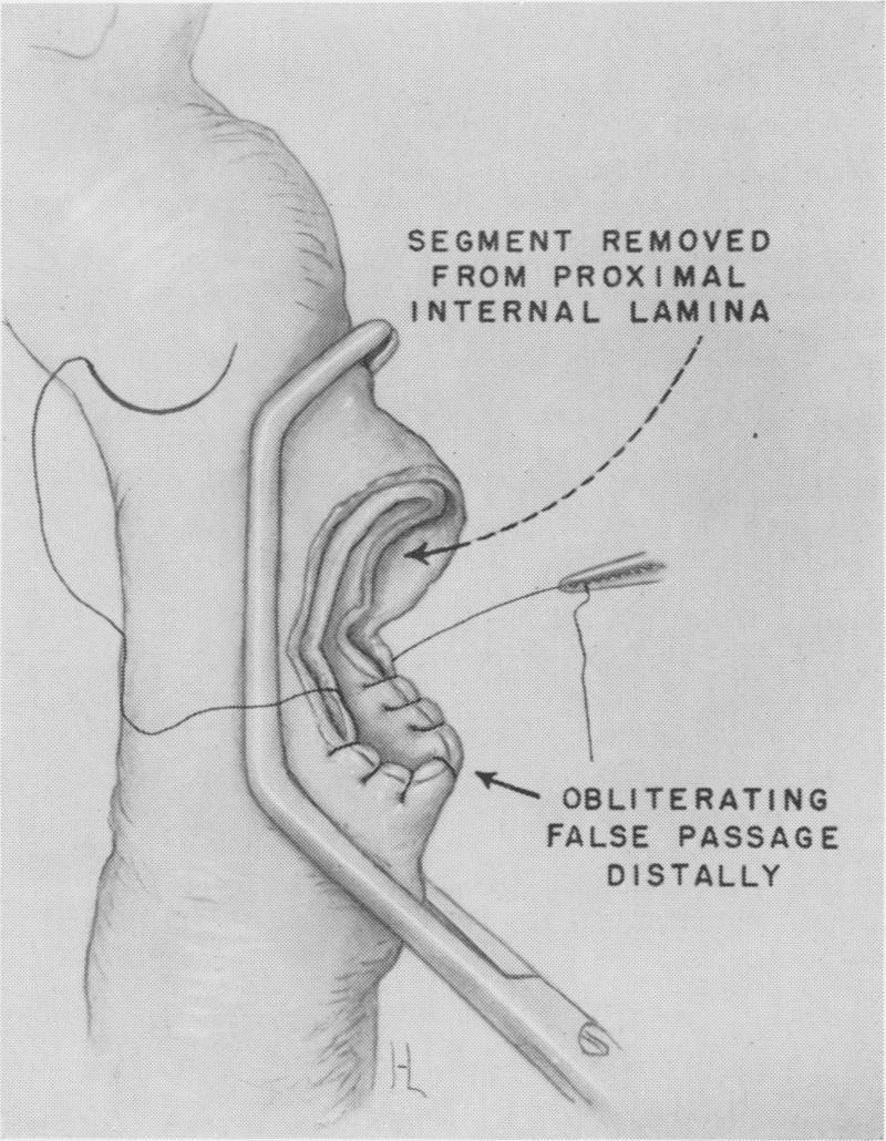 Fig. 14.