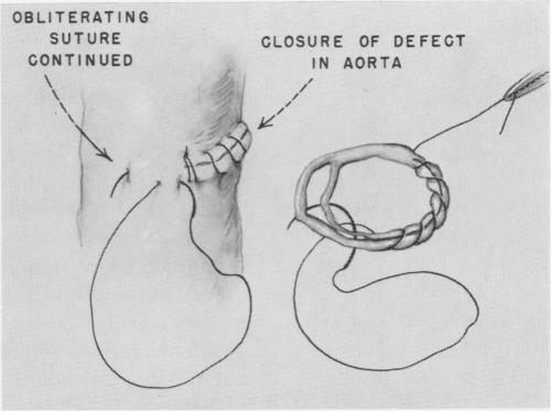 Fig. 15.