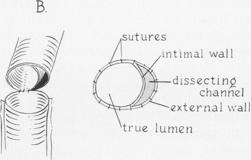 Fig. 1 B.