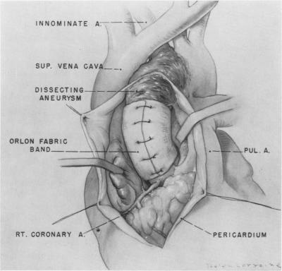 Fig. 16.