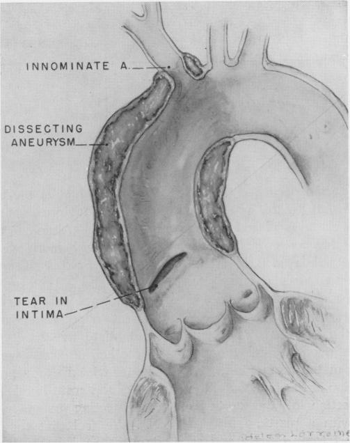 Fig. 13.