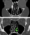 Fig. 3