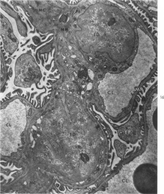 Fig. 16