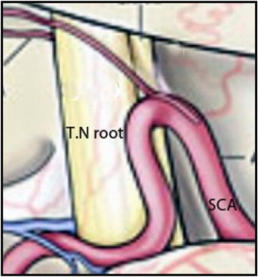 Fig. 1