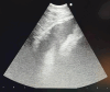 Figure 11.