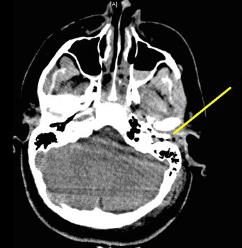 Fig. 3