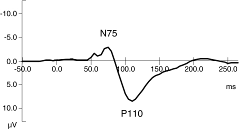 Fig. 2