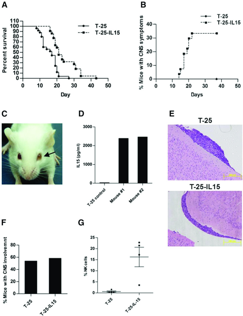 Figure 1. Constitutive expression of IL-15 in T-25 lymphoma cells increases survival of mice and is associated with clinical CNS symptoms. (A) Kaplan-Meier survival curve of 7-day-old BALB/C mice injected with either T-25-IL15 (n = 27) or T-25 cells (n = 28) (P < .0001, log-rank test). (B) Kaplan-Meier curve depicting the accumulated rate of CNS symptoms. Mice were monitored every day for clinical symptoms for CNS involvement including spin when held by tail, ataxia, and side-walk. These symptoms were present only in the T-25-IL15 group. (C) Representative picture of a T-25-IL15-injected mouse with ocular involvement. Note the opacity of the left eye (arrow) caused by accumulation of lymphoma cells in the left anterior chamber. (D) IL-15 secretion was measured by enzyme-linked immunosorbent assay in cells derived from the eyes of T-25-IL15-injected mice (n = 2). The T-25-injected mouse served as a control. (E-F) Hematoxylin and eosin staining of brain sections derived from T-25- (upper) and T-25-IL15-injected mice (lower), showing infiltration of lymphoma cells in the subarachnoid space. Histopathology analysis revealed that there was no difference in the number of mice with CNS involvement between both groups. (G) T-25-IL15-injected mice exhibited a significant increase in peripheral blood NK cells. Values presented as means ± SE (P = .01, t test).