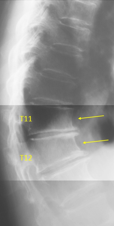 Figure 38