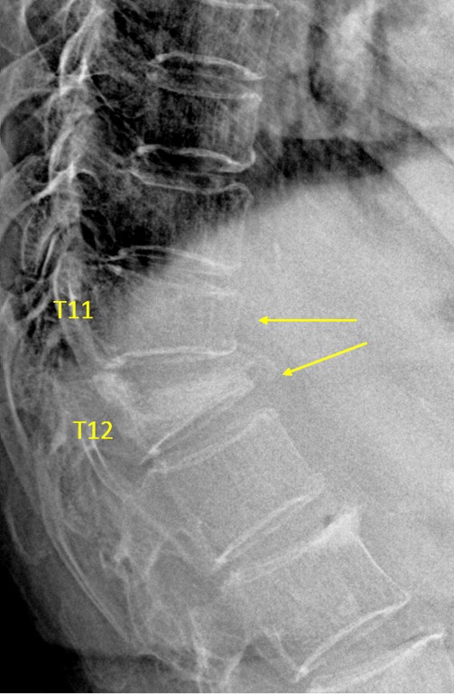 Figure 35