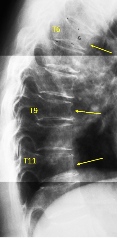 Figure 23