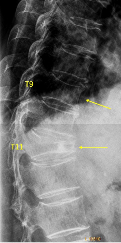 Figure 14