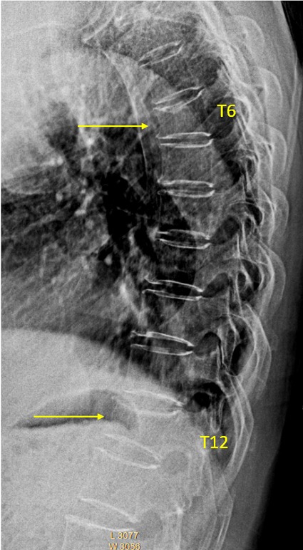 Figure 15