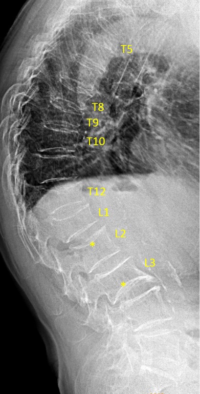 Figure 37