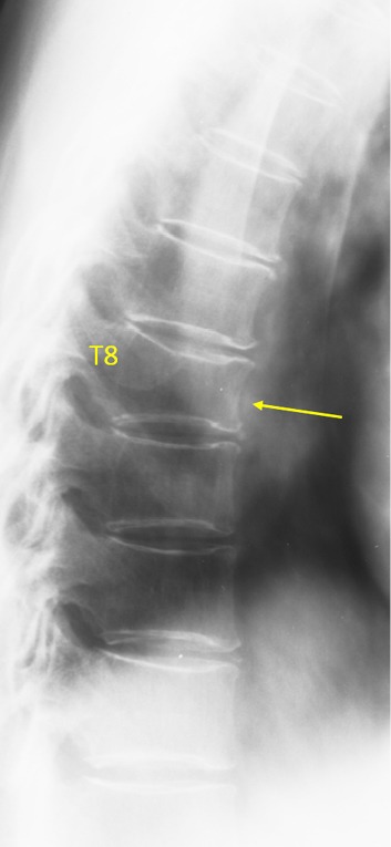 Figure 25