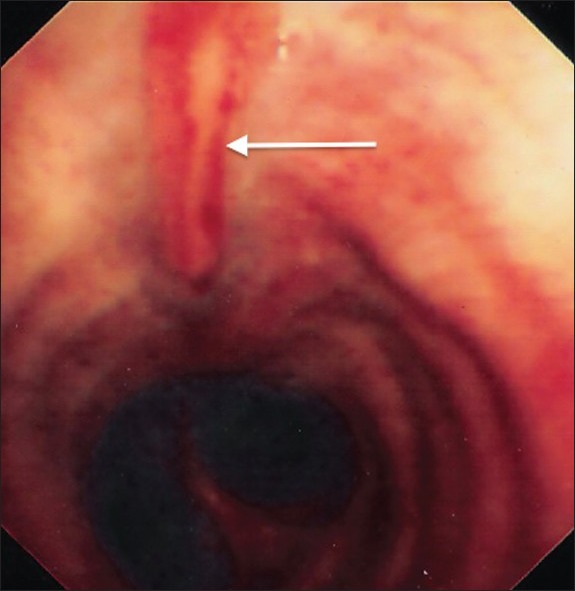 Figure 3b