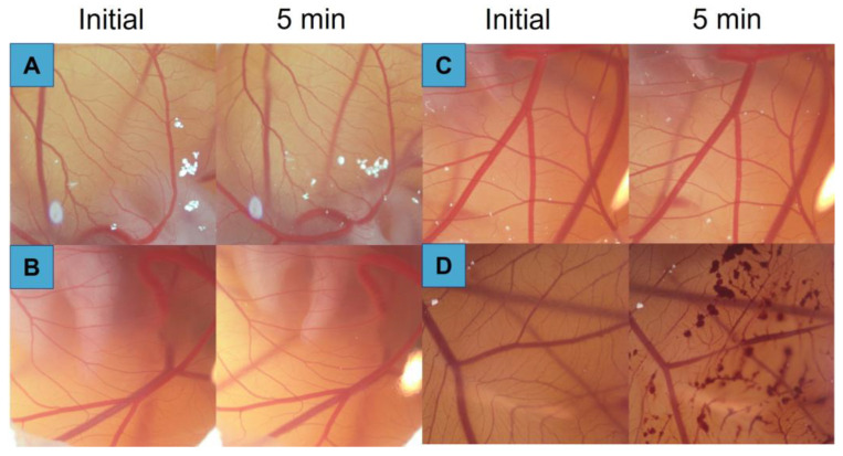 Figure 11