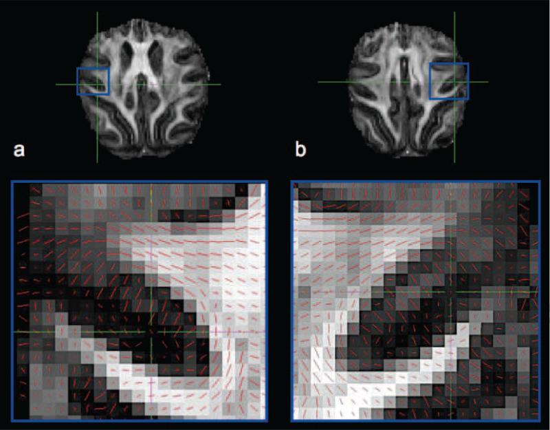 FIG. 12