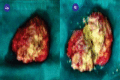 Figure 4 (a) and 4(b)