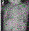 Image 2.