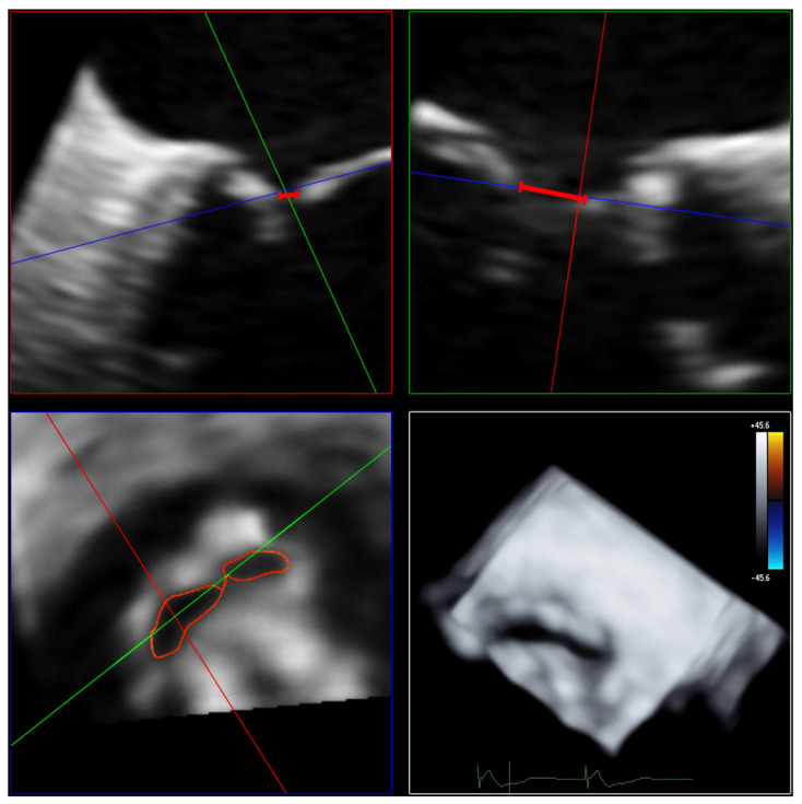 Figure 4