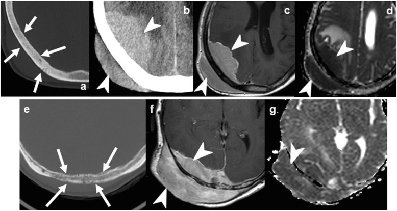 Fig. 14