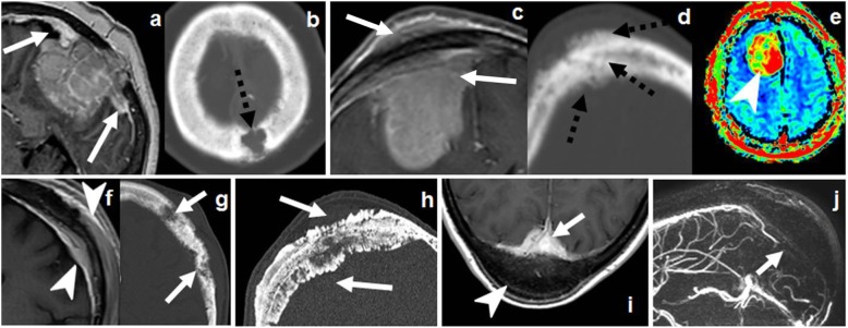 Fig. 12