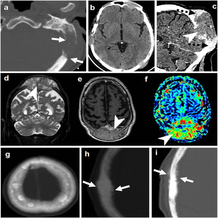 Fig. 8