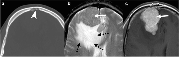 Fig. 13