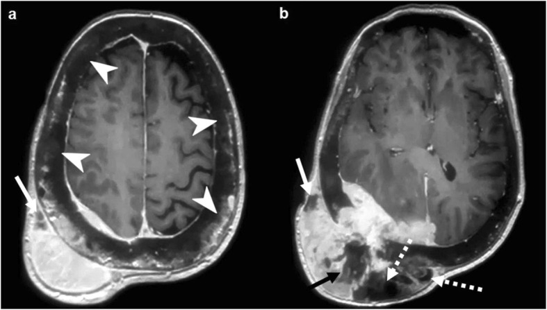 Fig. 11