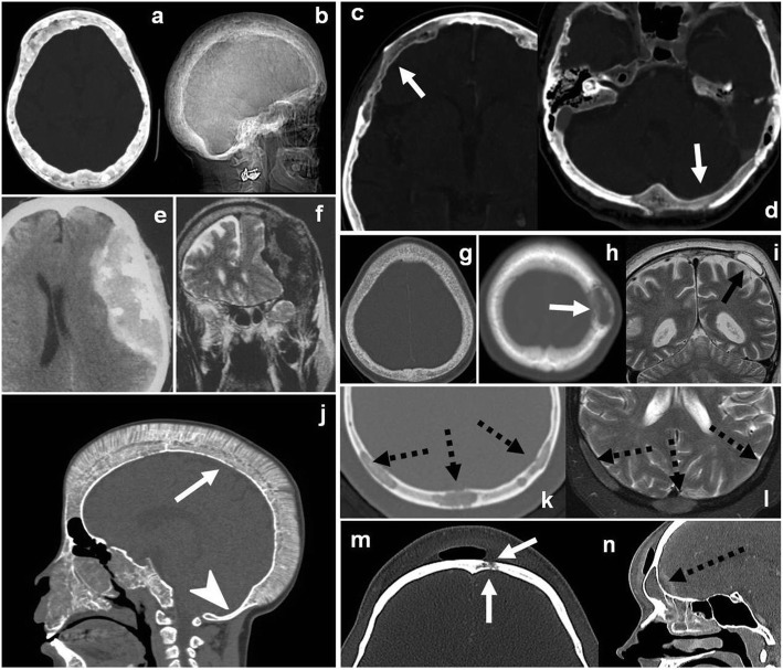 Fig. 16