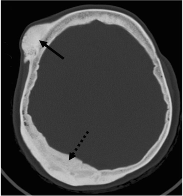 Fig. 10