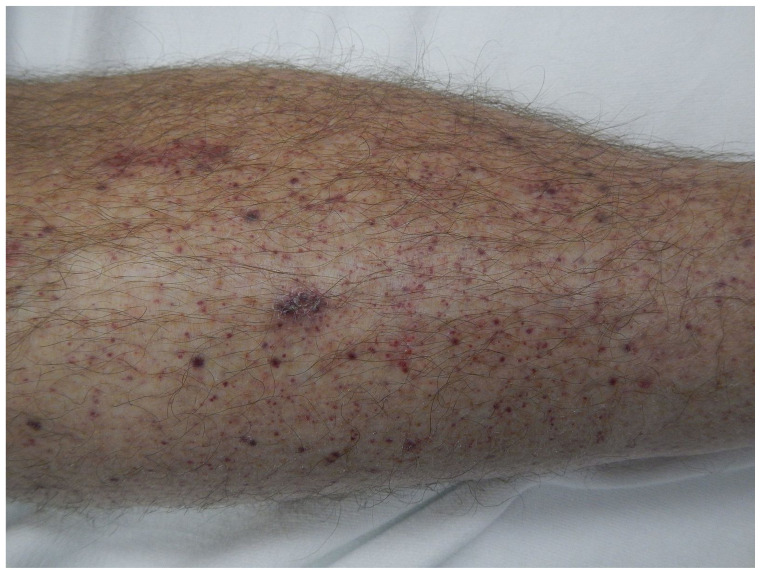 graphic file with name jetem-6-3-s1f2.jpg