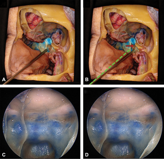 Fig. 4