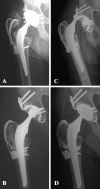 Fig. 3A–D