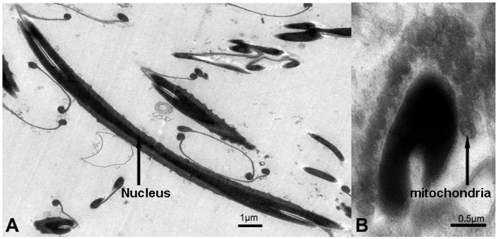 Figure 14